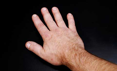 Outstretched Hand